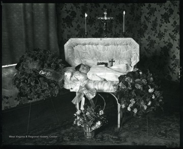 An unidentified child lays in a coffin in Grafton, West Virginia.