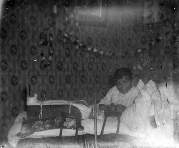 James Edwin Green, Jr., son of photographer James Edwin Green, Sr., is pictured laying in bed with a cast and splint on his left leg.